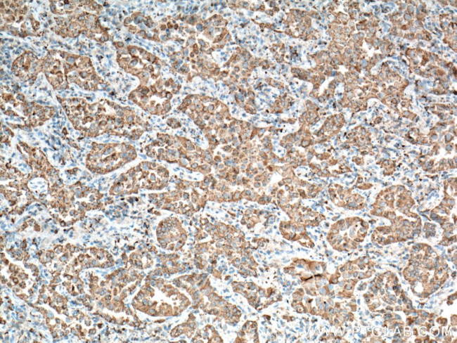 NAPSA Antibody in Immunohistochemistry (Paraffin) (IHC (P))