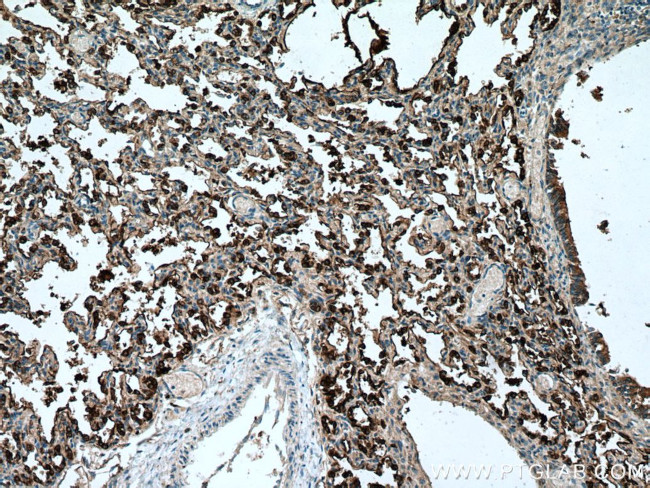 NAPSA Antibody in Immunohistochemistry (Paraffin) (IHC (P))