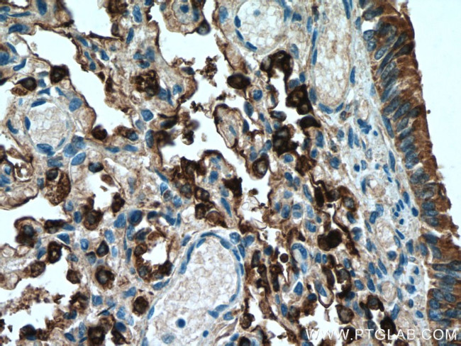 NAPSA Antibody in Immunohistochemistry (Paraffin) (IHC (P))