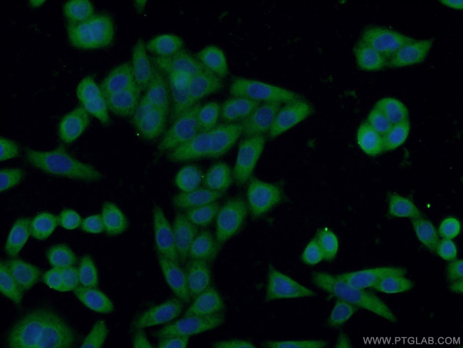 IL1R2 Antibody in Immunocytochemistry (ICC/IF)