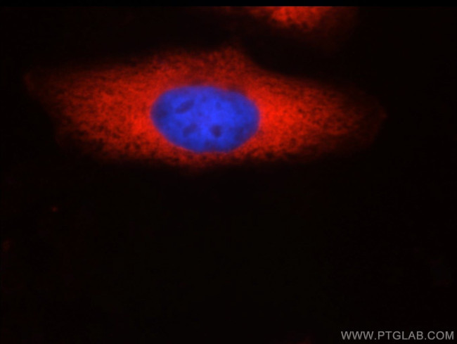 SND1 Antibody in Immunocytochemistry (ICC/IF)