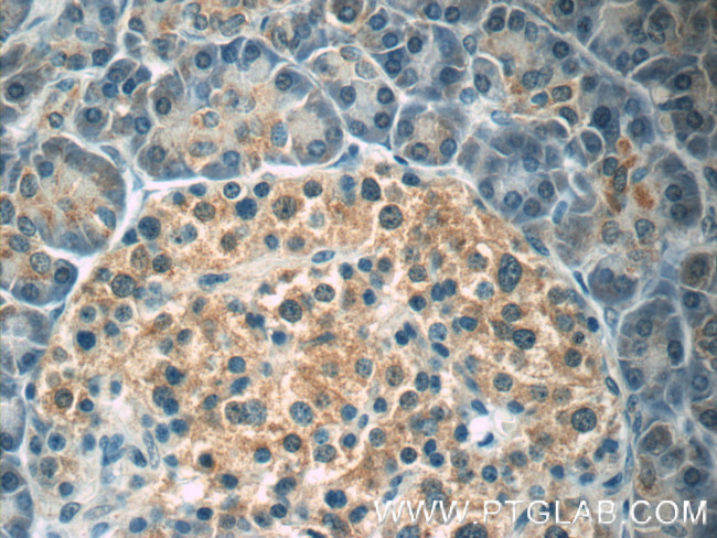 SND1 Antibody in Immunohistochemistry (Paraffin) (IHC (P))