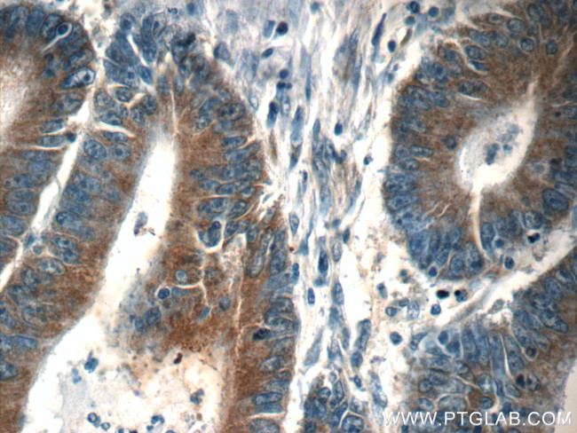 SND1 Antibody in Immunohistochemistry (Paraffin) (IHC (P))