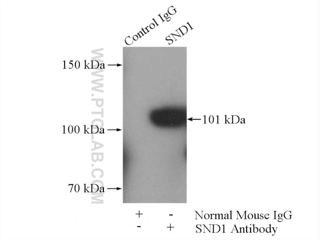 SND1 Antibody in Immunoprecipitation (IP)