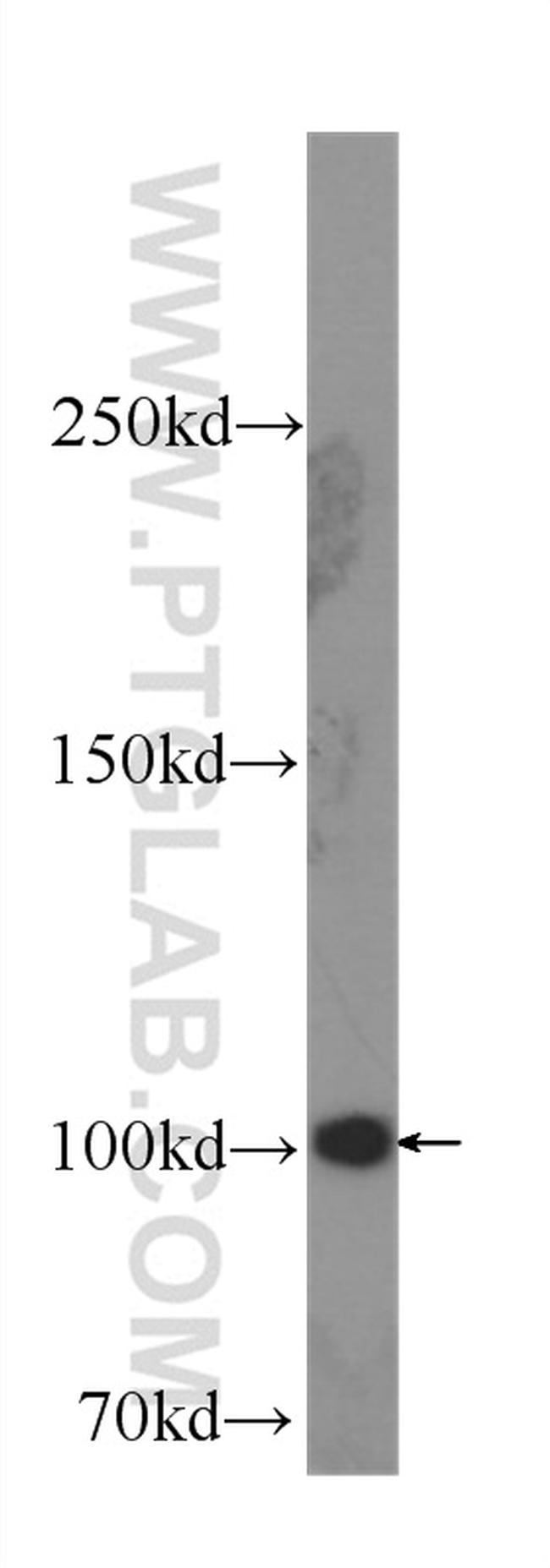 SND1 Antibody in Western Blot (WB)