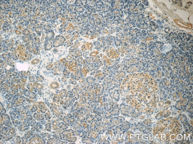 SND1 Antibody in Immunohistochemistry (Paraffin) (IHC (P))