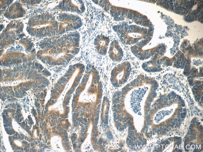 SND1 Antibody in Immunohistochemistry (Paraffin) (IHC (P))