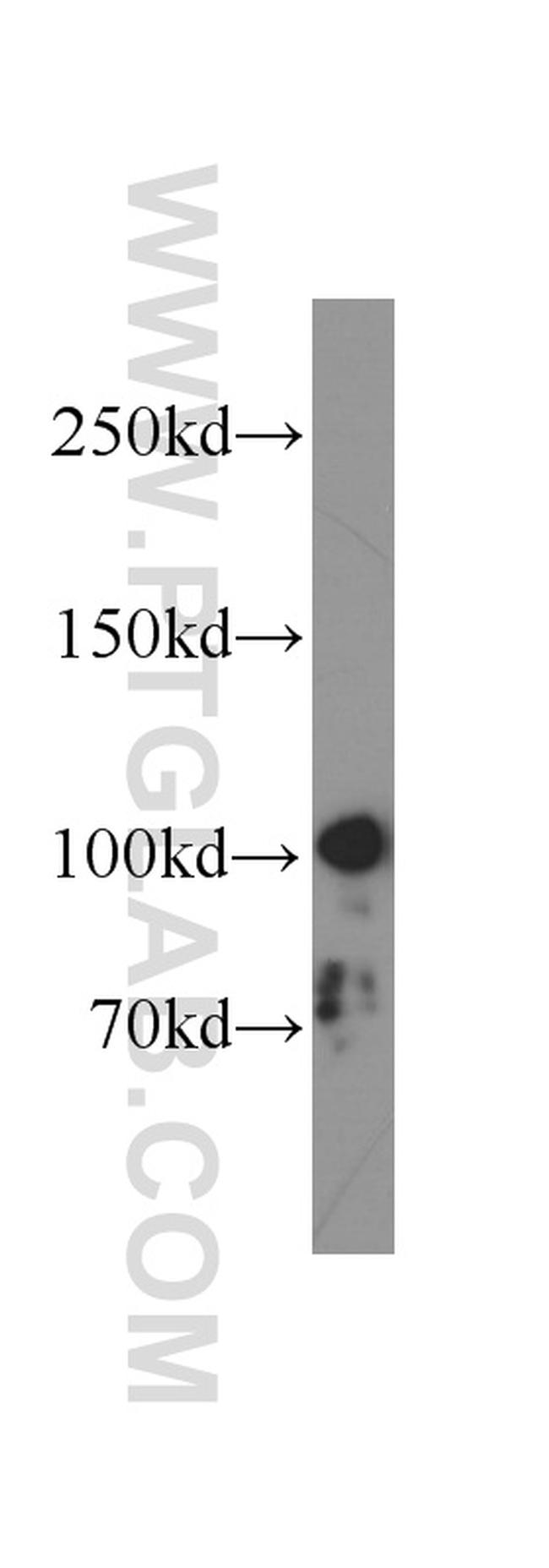 SND1 Antibody in Western Blot (WB)