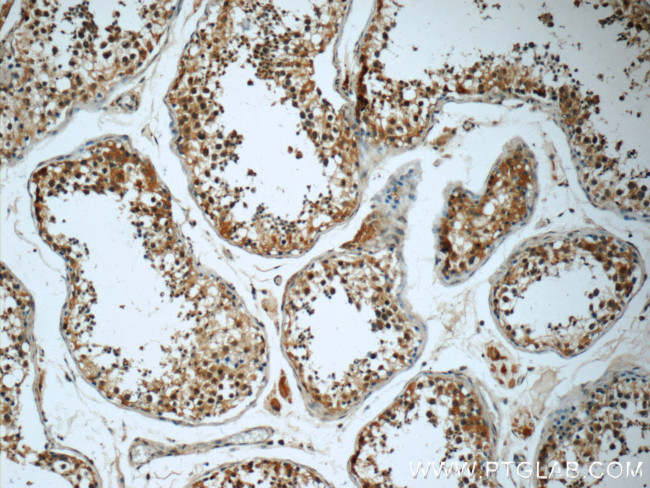 KIFAP3 Antibody in Immunohistochemistry (Paraffin) (IHC (P))