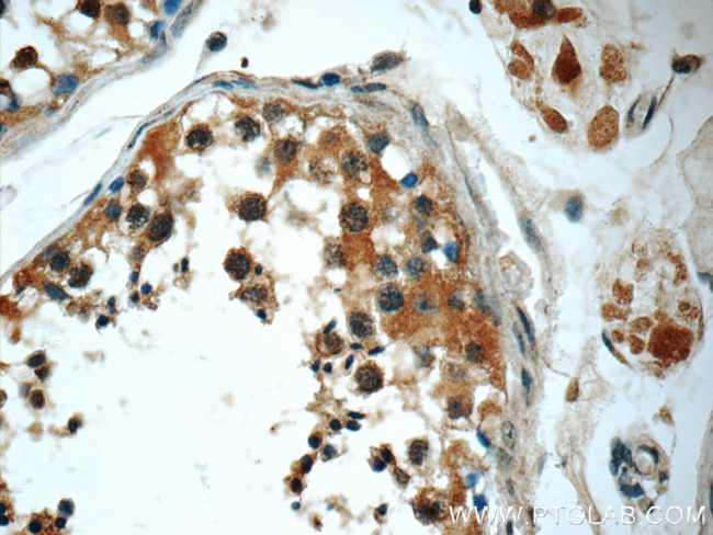 KIFAP3 Antibody in Immunohistochemistry (Paraffin) (IHC (P))