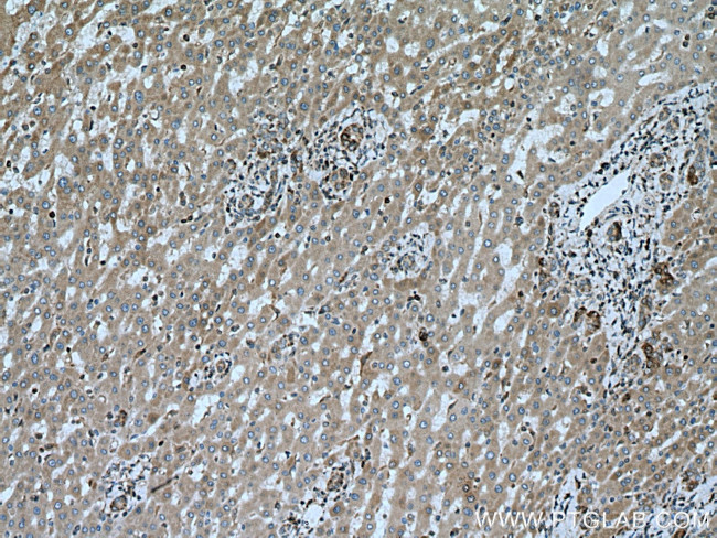 BAX Antibody in Immunohistochemistry (Paraffin) (IHC (P))