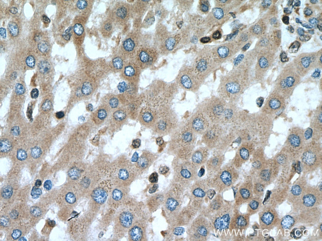 BAX Antibody in Immunohistochemistry (Paraffin) (IHC (P))