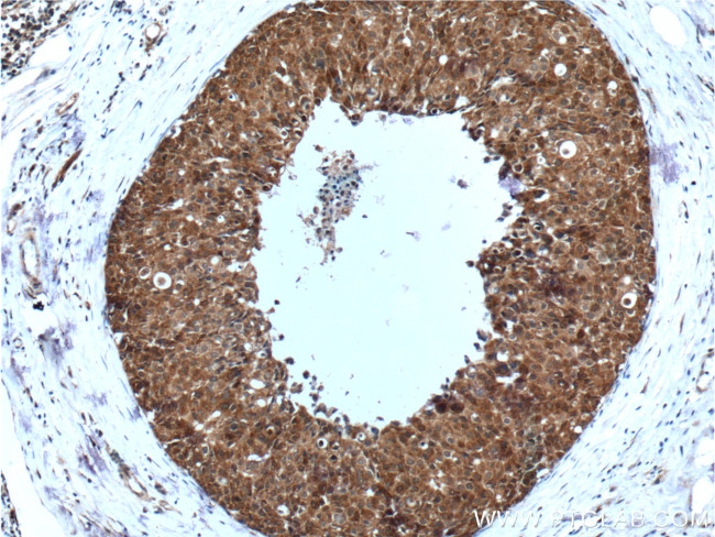 BAX Antibody in Immunohistochemistry (Paraffin) (IHC (P))