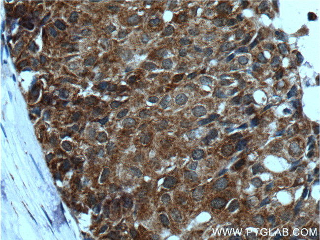 BAX Antibody in Immunohistochemistry (Paraffin) (IHC (P))