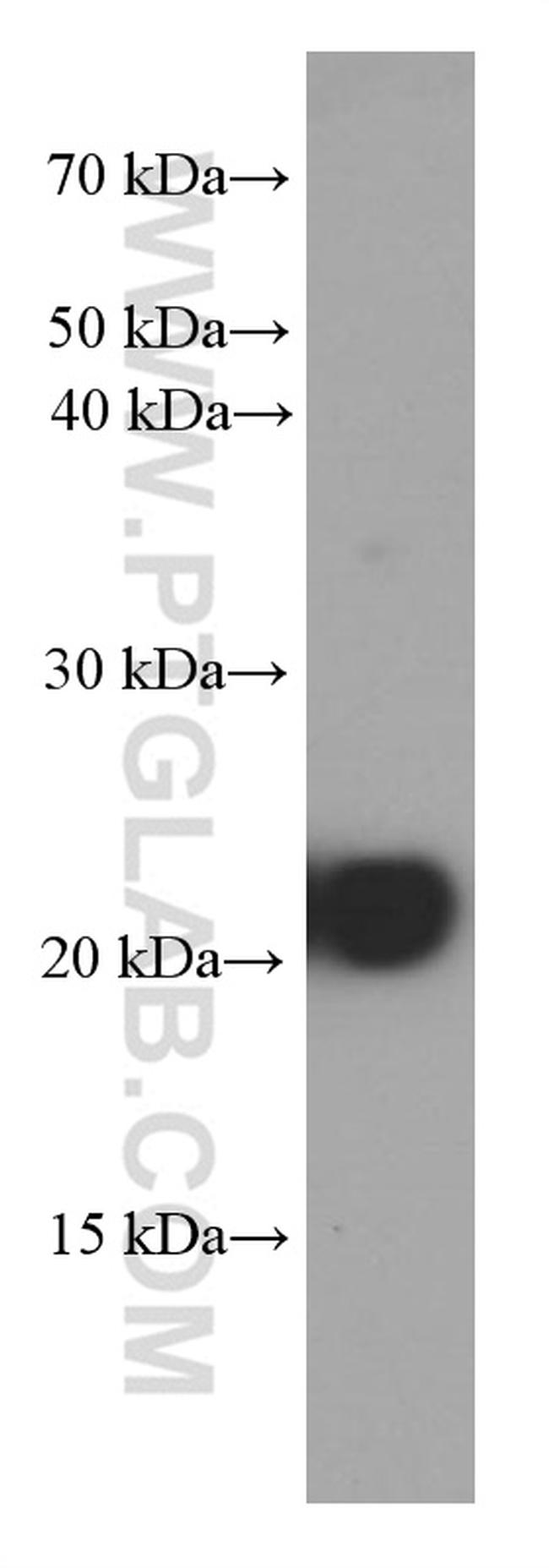 BAX Antibody in Western Blot (WB)