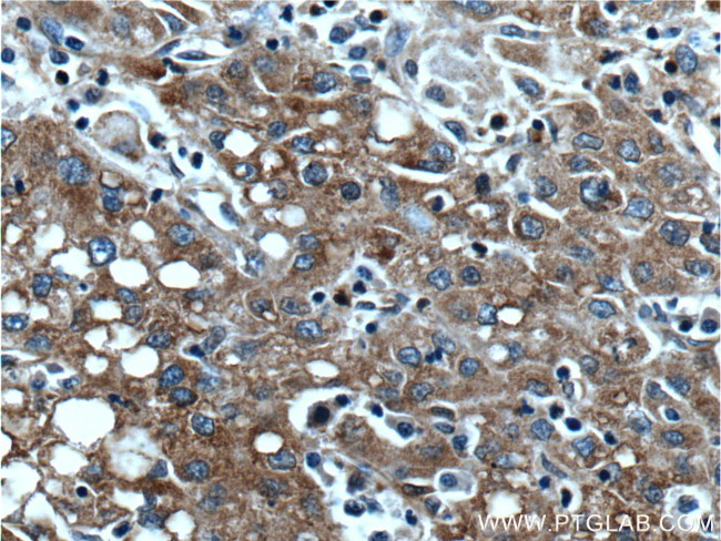 BAX Antibody in Immunohistochemistry (Paraffin) (IHC (P))