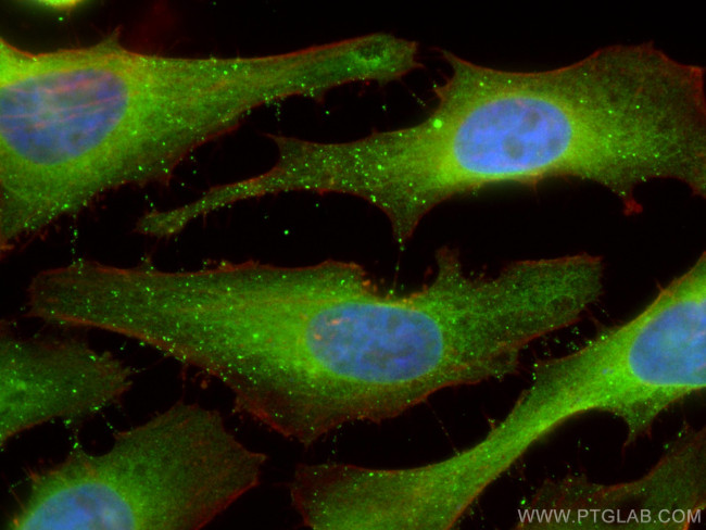 PKM2 Antibody in Immunocytochemistry (ICC/IF)