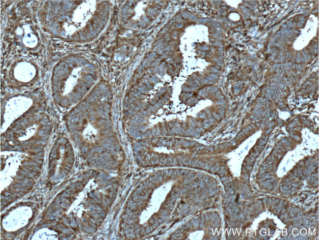 PKM2 Antibody in Immunohistochemistry (Paraffin) (IHC (P))