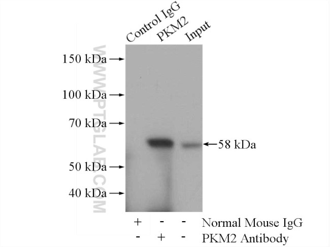 PKM2 Antibody in Immunoprecipitation (IP)