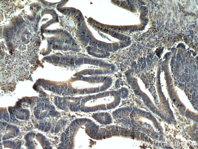 PKM2 Antibody in Immunohistochemistry (Paraffin) (IHC (P))