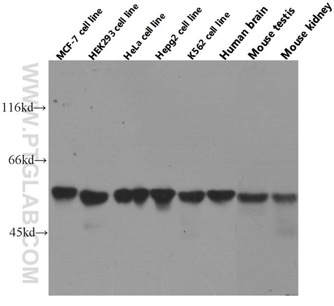 PKM2 Antibody in Western Blot (WB)