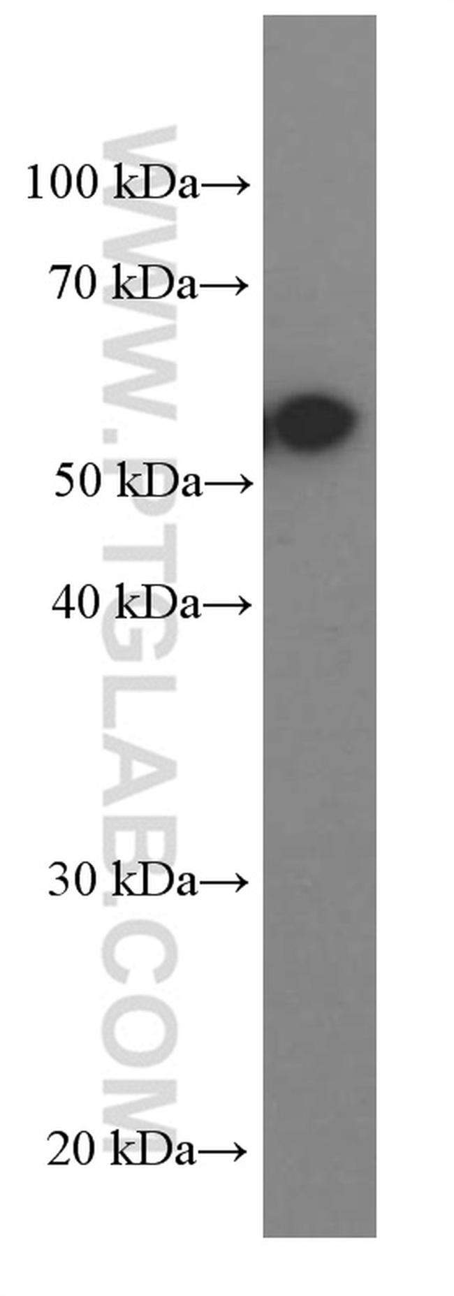 PKM2 Antibody in Western Blot (WB)