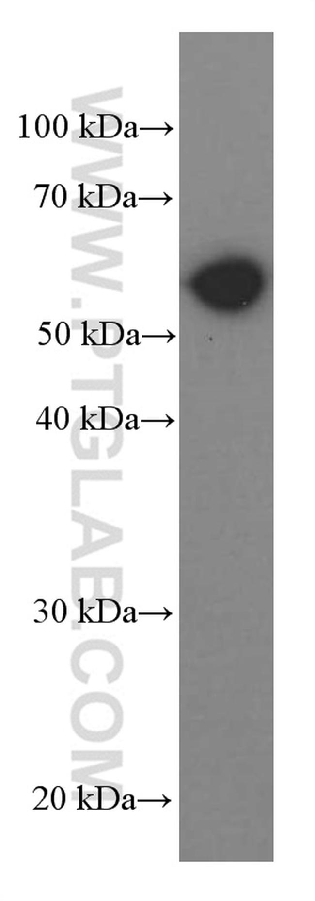 PKM2 Antibody in Western Blot (WB)