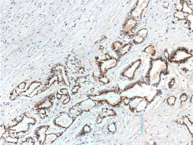 IL-10 Antibody in Immunohistochemistry (Paraffin) (IHC (P))