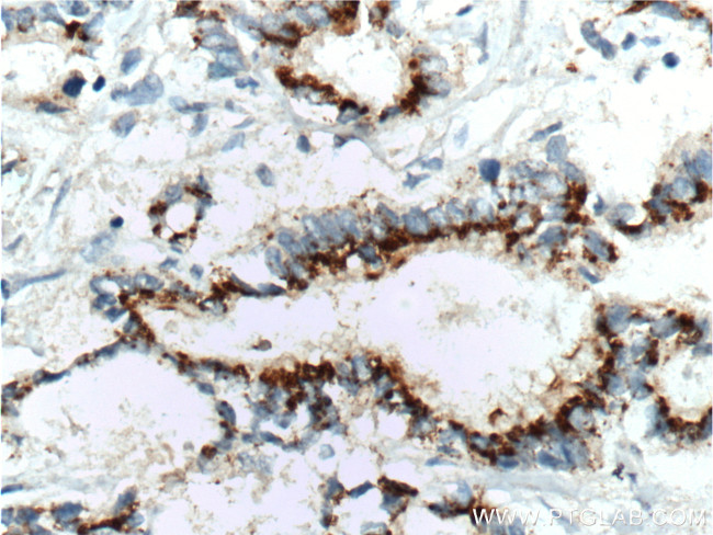 IL-10 Antibody in Immunohistochemistry (Paraffin) (IHC (P))