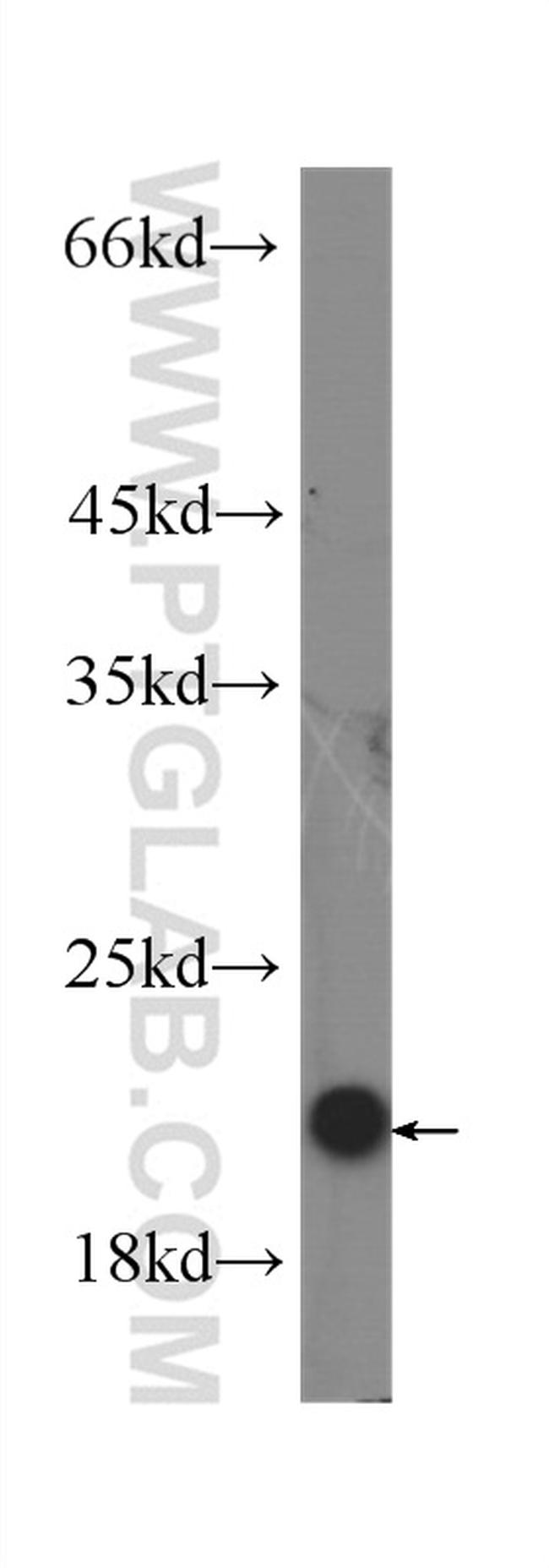 IL-10 Antibody in Western Blot (WB)