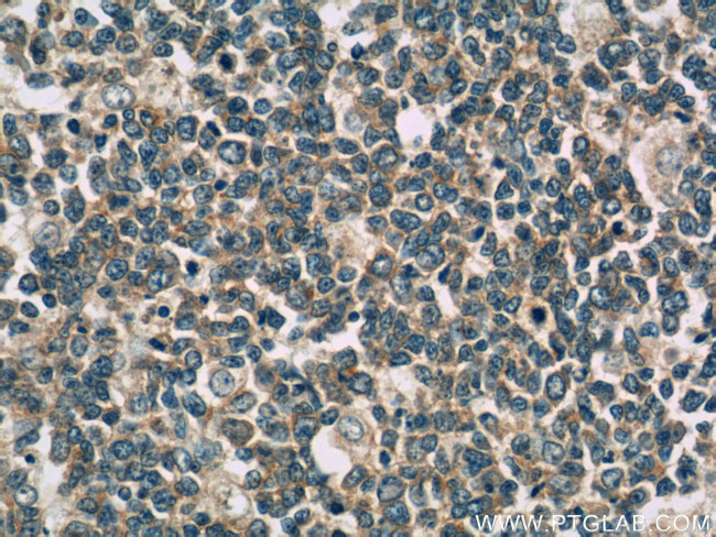 IL-28A Antibody in Immunohistochemistry (Paraffin) (IHC (P))