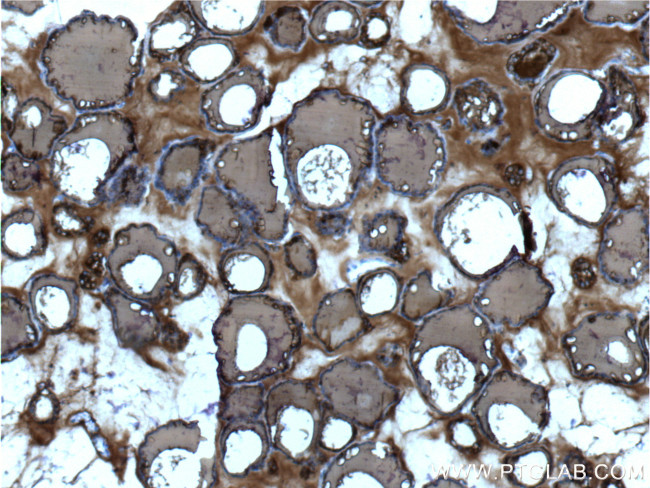 Thyroglobulin Antibody in Immunohistochemistry (Paraffin) (IHC (P))