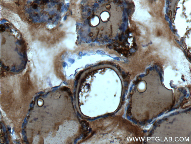 Thyroglobulin Antibody in Immunohistochemistry (Paraffin) (IHC (P))