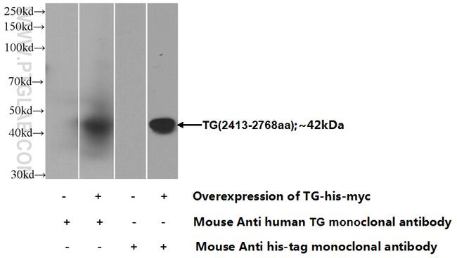 Thyroglobulin Antibody in Western Blot (WB)