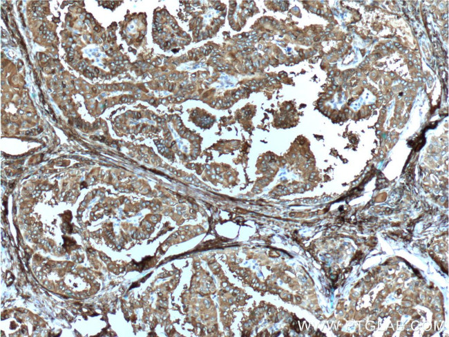 Thyroglobulin Antibody in Immunohistochemistry (Paraffin) (IHC (P))