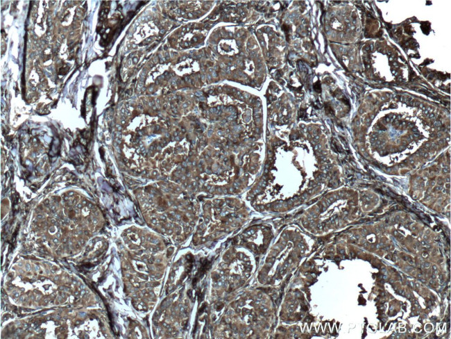 Thyroglobulin Antibody in Immunohistochemistry (Paraffin) (IHC (P))