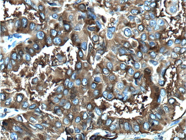 Thyroglobulin Antibody in Immunohistochemistry (Paraffin) (IHC (P))