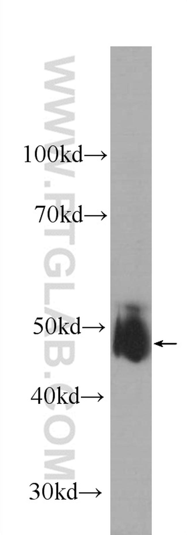 KCNN4 Antibody in Western Blot (WB)