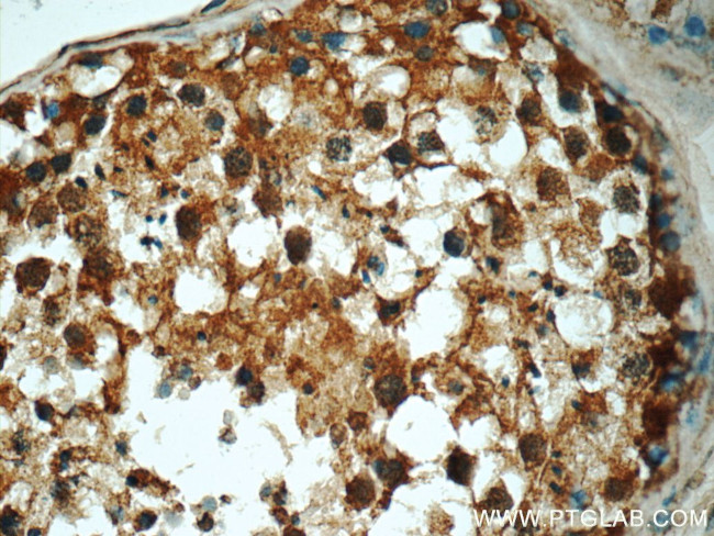 Chk1 Antibody in Immunohistochemistry (Paraffin) (IHC (P))