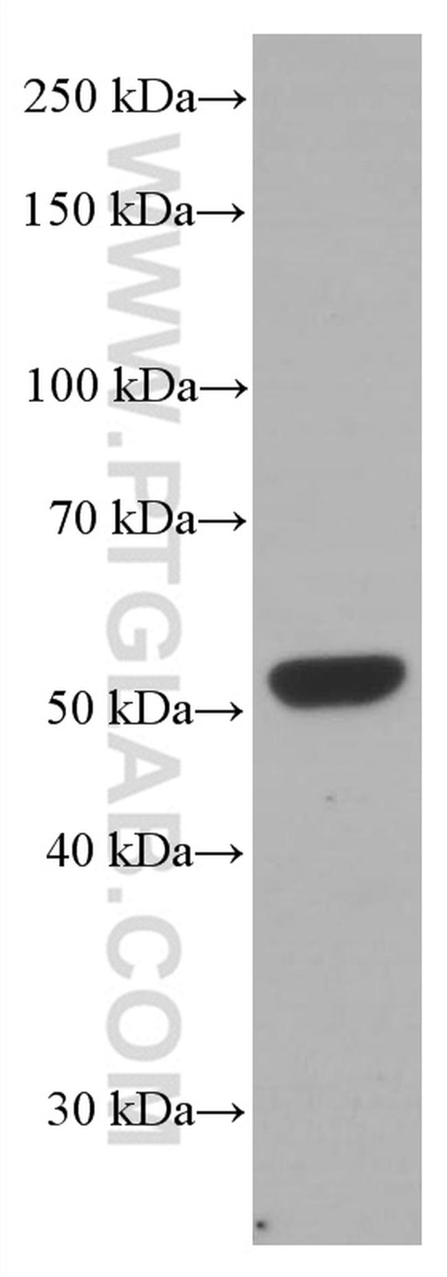 Chk1 Antibody in Western Blot (WB)