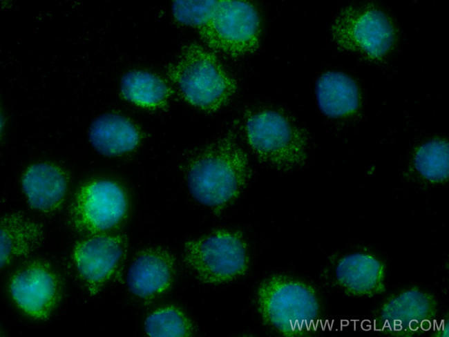 IL-19 Antibody in Immunocytochemistry (ICC/IF)