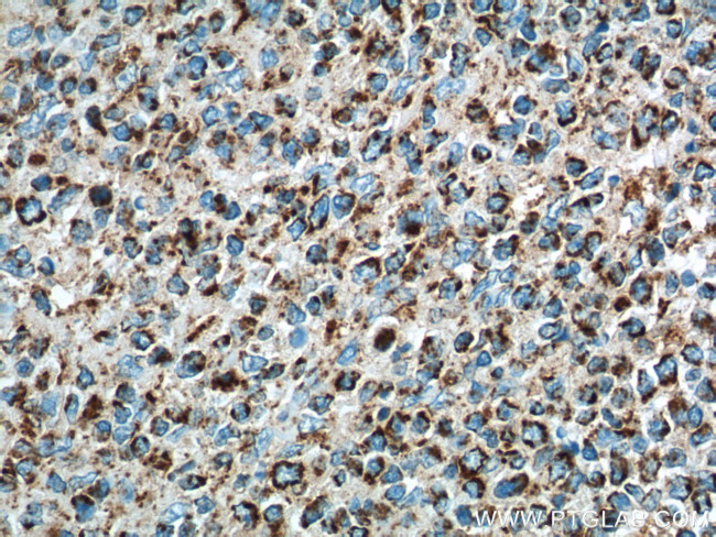 IL-19 Antibody in Immunohistochemistry (Paraffin) (IHC (P))