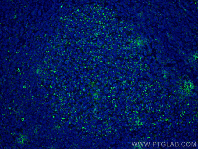 IL-19 Antibody in Immunohistochemistry (PFA fixed) (IHC (PFA))