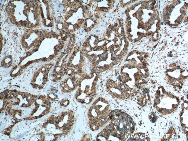 IL-19 Antibody in Immunohistochemistry (Paraffin) (IHC (P))