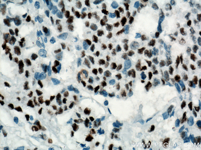 P53 Antibody in Immunohistochemistry (Paraffin) (IHC (P))
