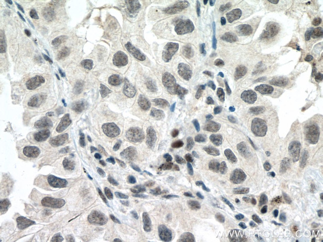 P53 Antibody in Immunohistochemistry (Paraffin) (IHC (P))