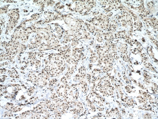 P53 Antibody in Immunohistochemistry (Paraffin) (IHC (P))