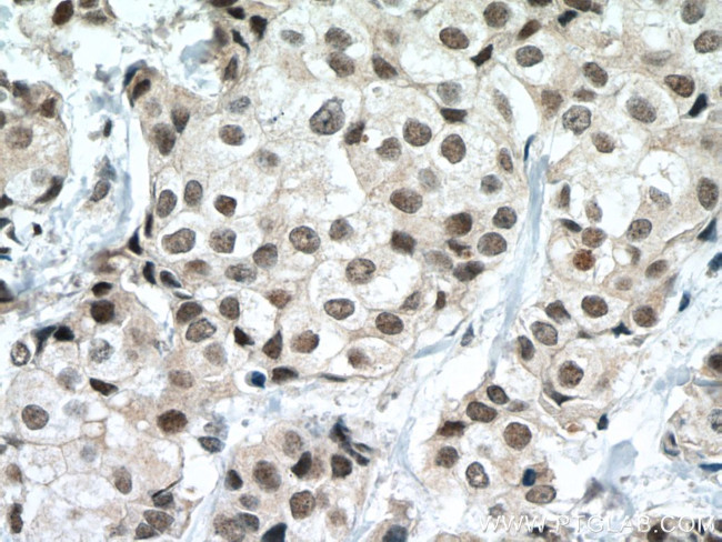 P53 Antibody in Immunohistochemistry (Paraffin) (IHC (P))