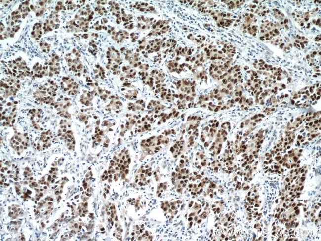 P53 Antibody in Immunohistochemistry (Paraffin) (IHC (P))