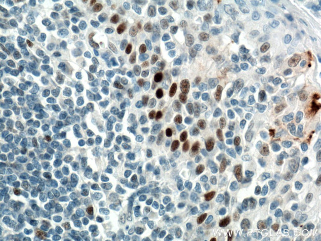 P53 Antibody in Immunohistochemistry (Paraffin) (IHC (P))